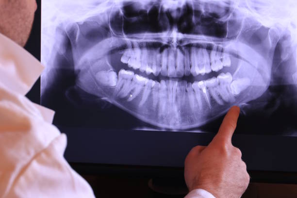 Best Chipped Tooth Repair Near Me  in White Rock, NM