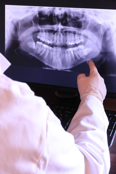 Teeth Whitening in NM
