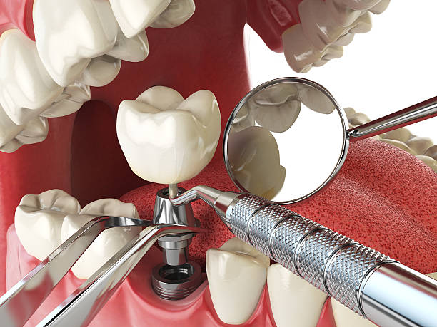 Dentist for Dental Trauma in NM